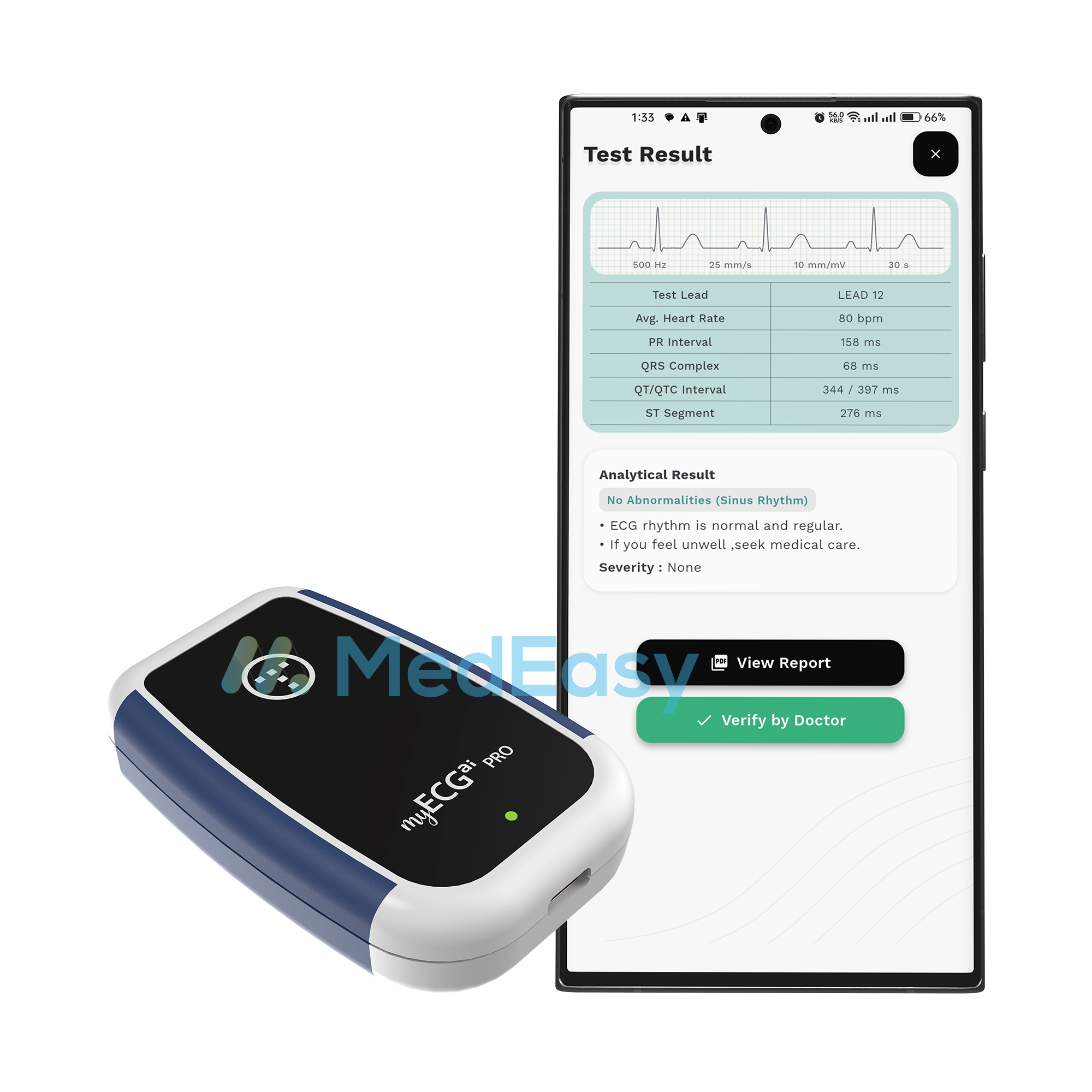 myECGai Pro