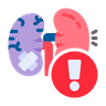 Kidney Stone
