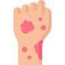 Skin Rash