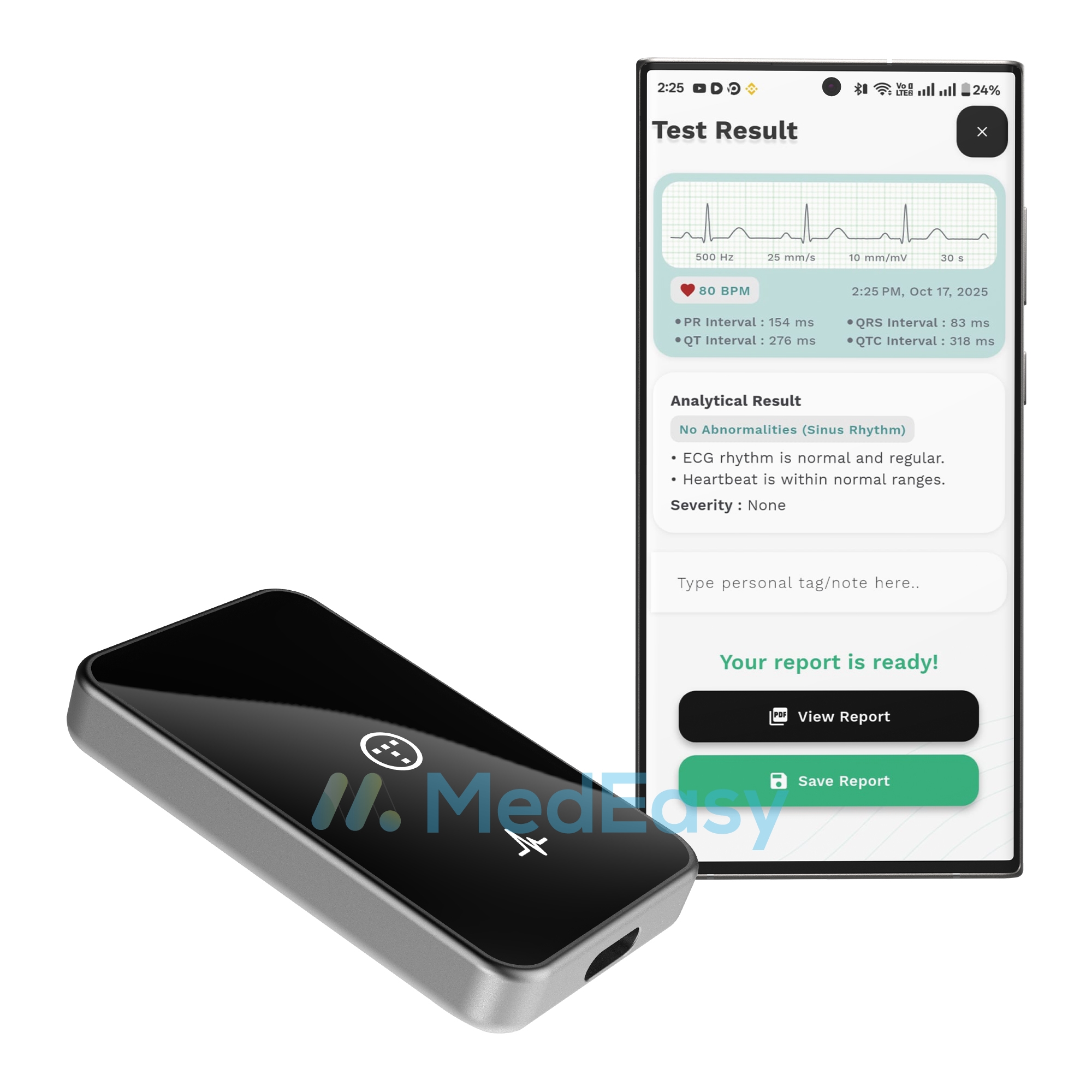 myECGai Plus